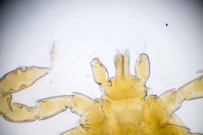 mite under light microscopy